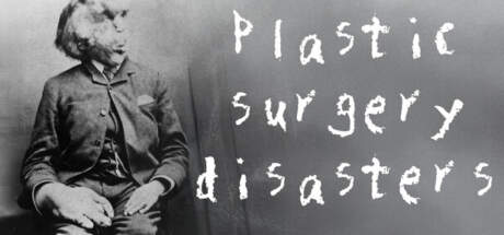 Rising Star 2 Plastic Surgery Disasters-SKIDROW Rising Star 2 Plastic Surgery Disasters-SKIDROW